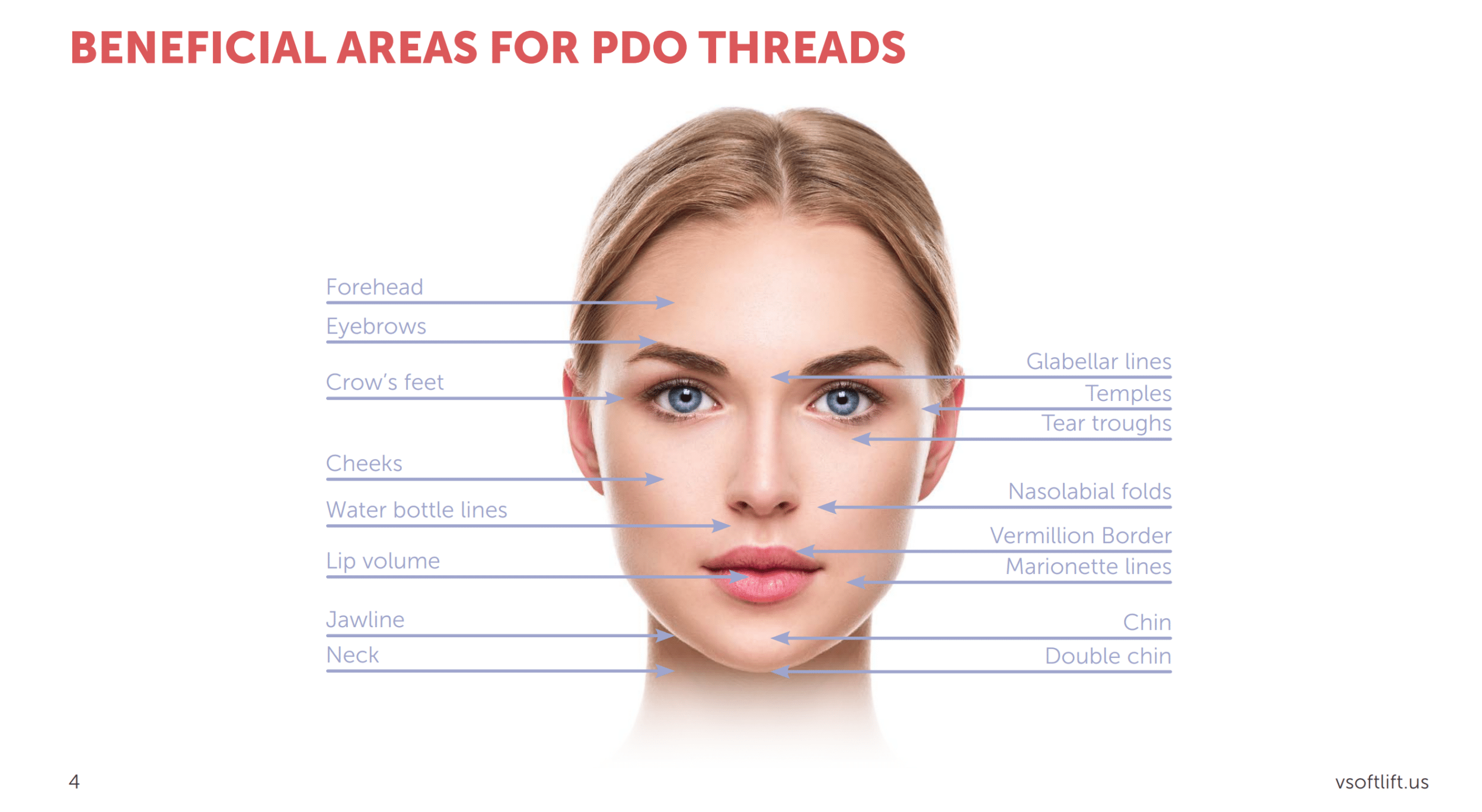PDO treatment areas